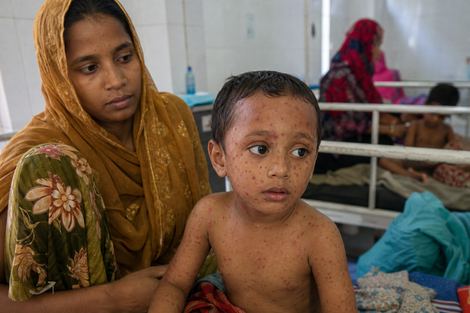 AI Generated - Bangladesh Records 1,115 New Measles Cases in One Day